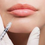 Medicina estetica
