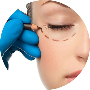 The face surgery - Blefaroplastica